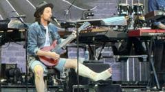 James Bay performs with broken ankle at Bon Jovi gig
