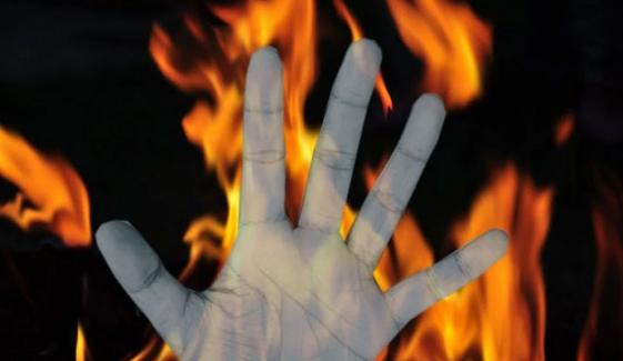 شکارپور: پراپرٹی کا تنازع، 10 سالہ بچے پر پیٹرول چھڑک کر آگ لگا دی گئی